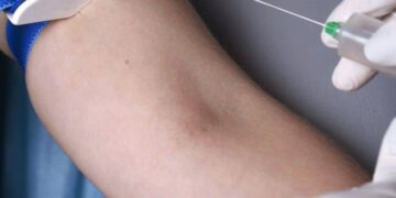 What you need to do to get a medical fitness test in the UAE?